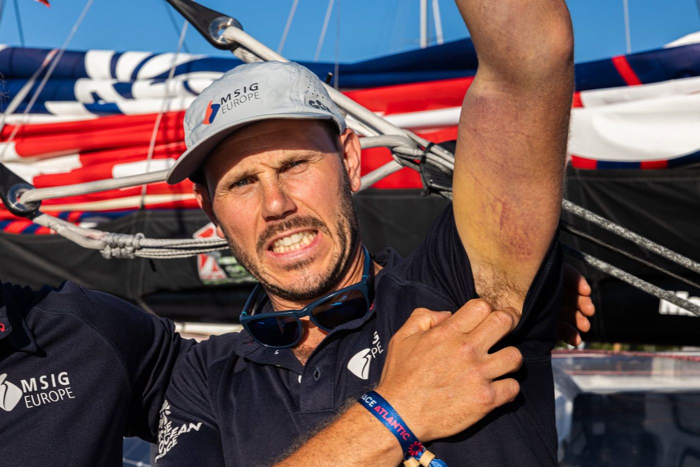 Aaron Hume-Merry took signficant bruising and dislocated his shoulder in a sail change en-route from Europe to the US