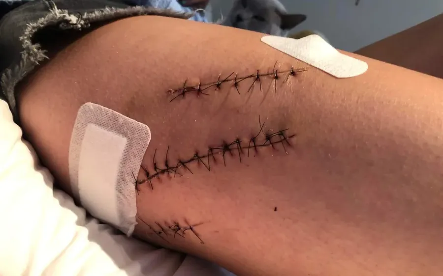One-of-the-victims-injuries.-Photo-Supplied-.webp