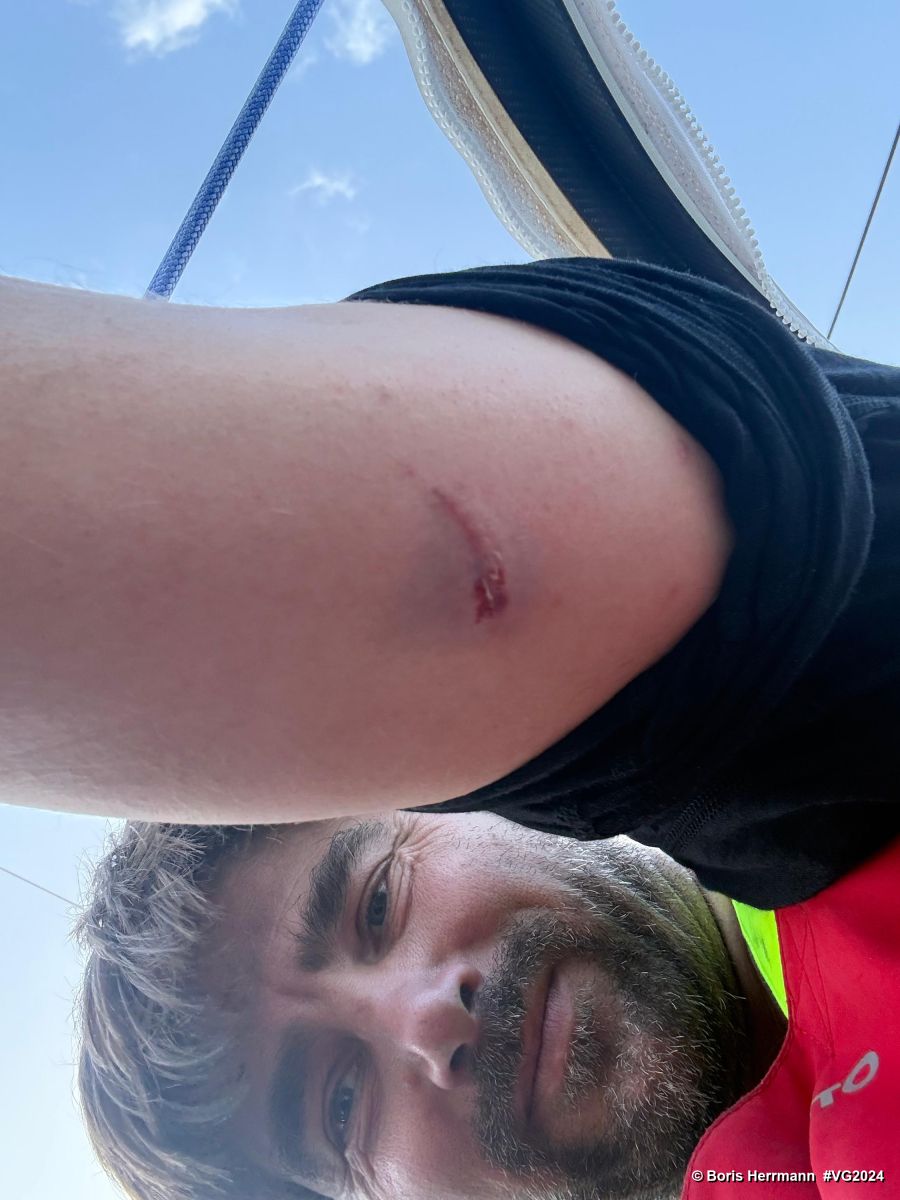 Photo sent from the boat Malizia - Seaexplorer during the Vendee Globe sailing race on January 16, 2025. Photo credit: skipper Boris Herrmann. Foil damaged
